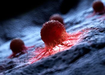 Revoluție în tratamentul cancerului: O terapie promițătoare, rezultate încurajatoare!